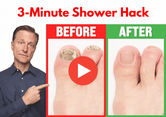 before - after fungus